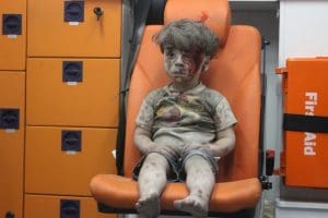Omran, a Syrian boy, awaits treatment. (Mahmoud Rslan/Agence France-Presse via Getty Images)